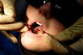 One in 10 people have performed DIY dentistry, poll finds