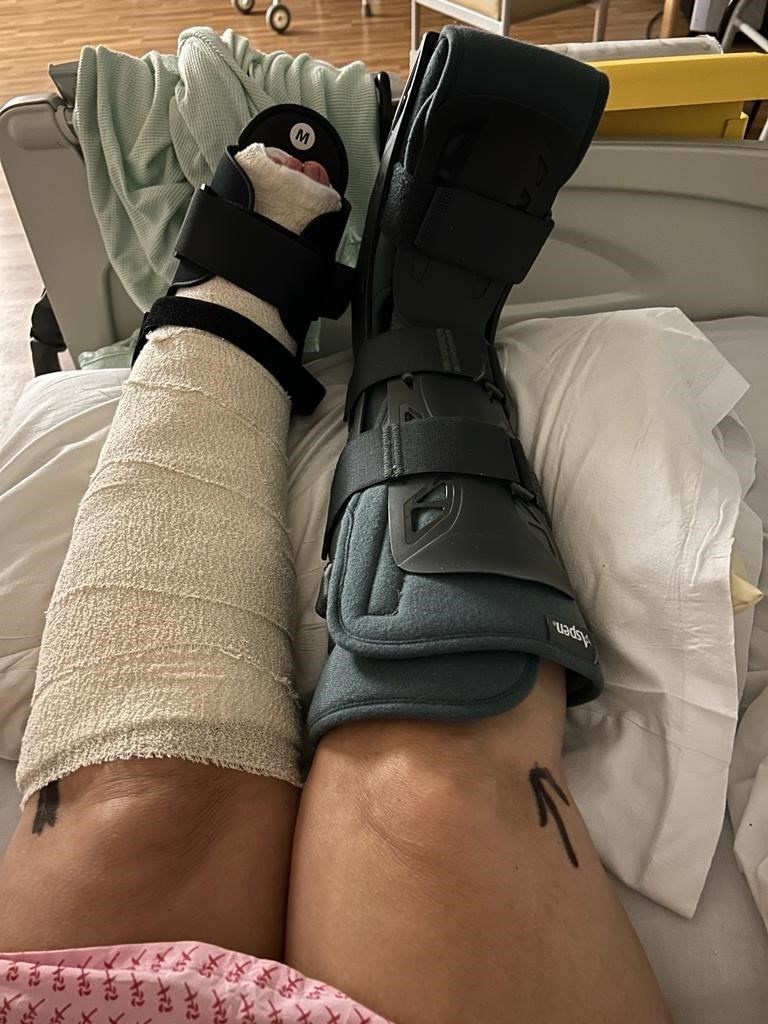Elizabeth Donowho broke both ankles in the crash in July (Elizabeth Donowho/PA)