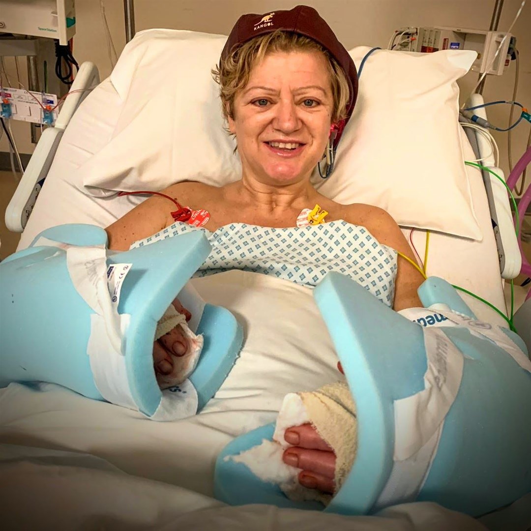 Cor Hutton after her hand transplant (Finding Your Feet/PA)