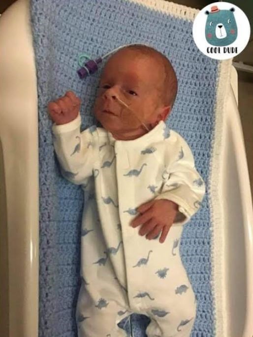 Ackie Little weighed 2lb 8oz when he and sister Alara arrived on January 1.