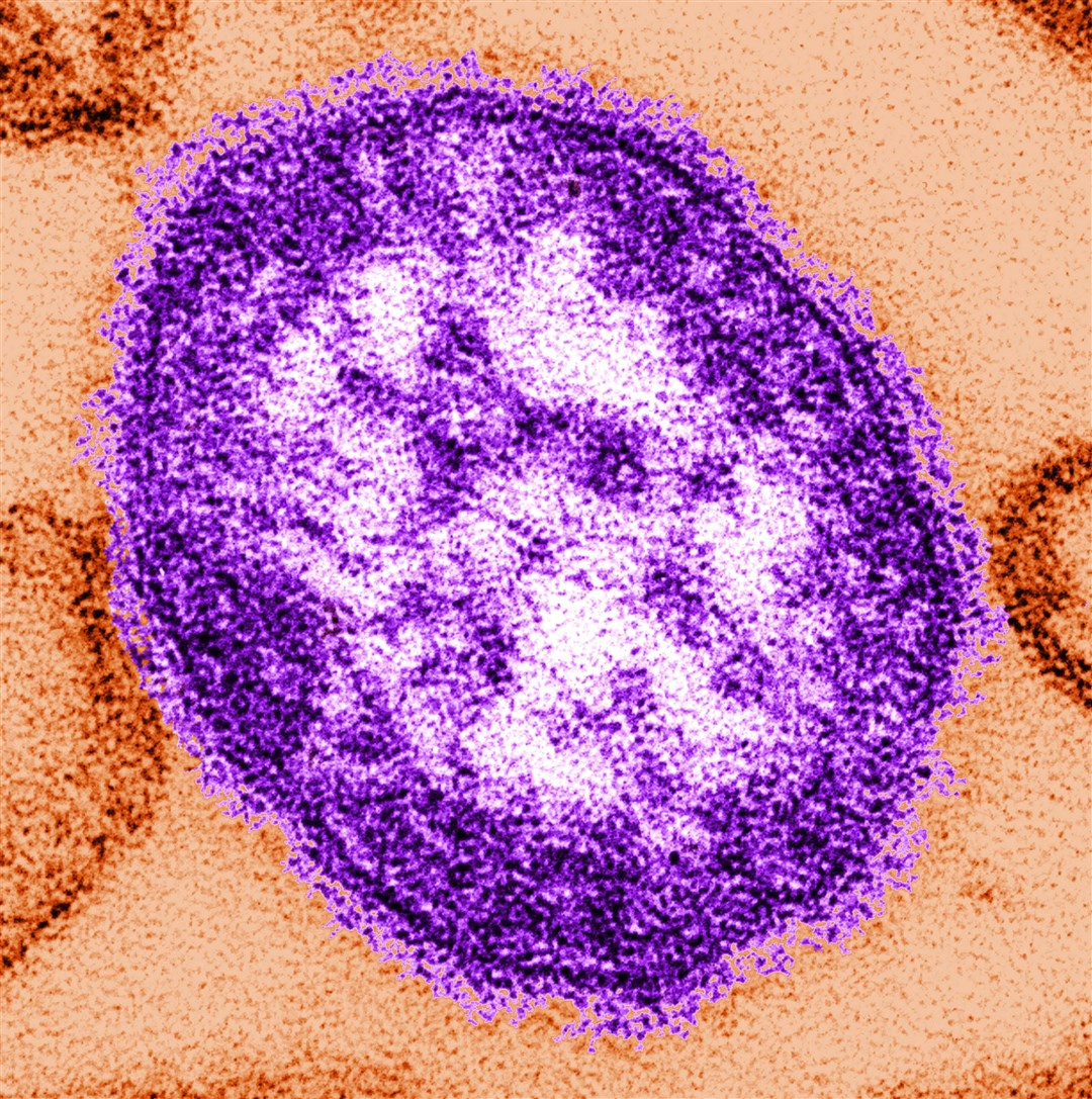 An image issued by the Centers for Disease Control and Prevention of the Measles virus (Cynthia Goldsmith/PA)